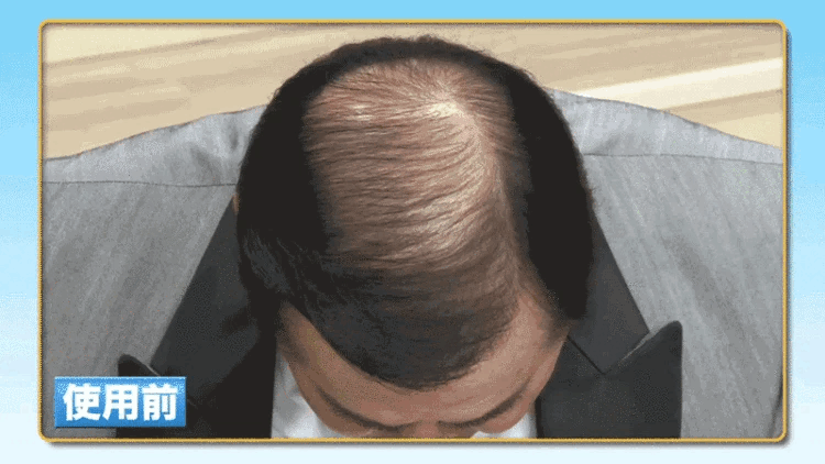 1772001461956410.gif 27a651b3-858b-42e5-a106-1afa57232a55.gif